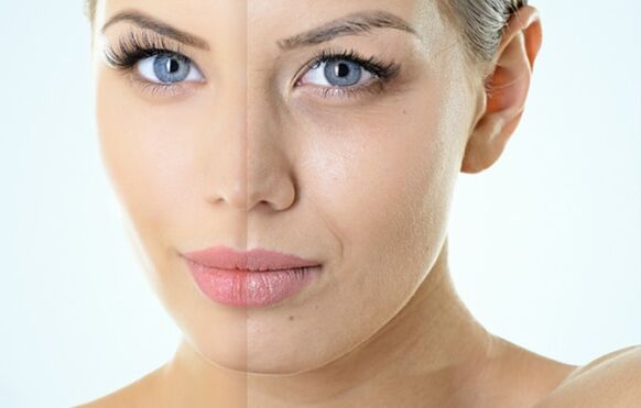 Kesirli gençleşme endikasyonları